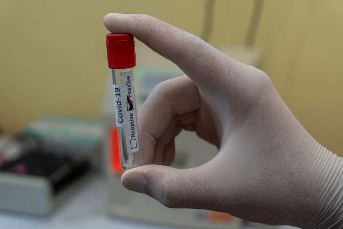 Researchers pointed out that COVID-19 will eventually become a seasonal disease. (Representational Image, Photo by: Prasesh Shiwakoti Lomash/ Unsplash)
